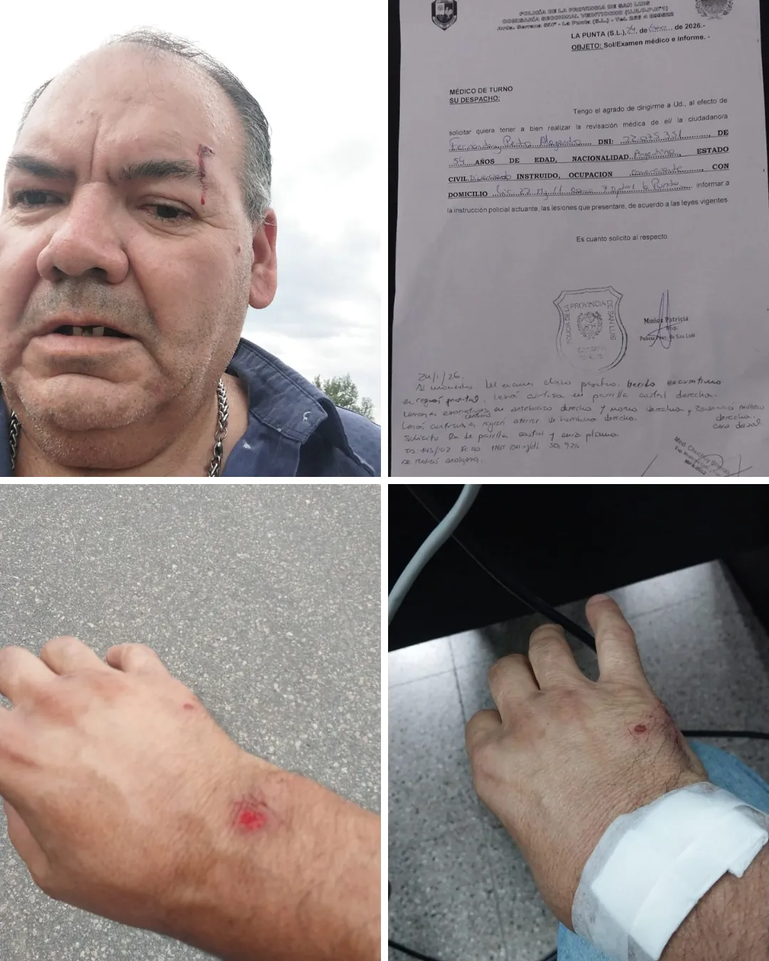 PLACAS EL MOSQUITO - 2026-01-24T232208.766